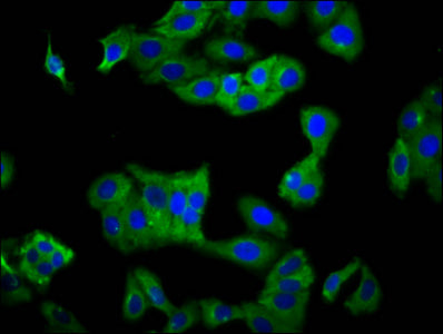 Immunofluorescence staining of HepG2 cells with CSB-PA619902LA01HU at 1:100, counter-stained with DAPI. The cells were fixed in 4% formaldehyde, permeabilized using 0.2% Triton X-100 and blocked in 10% normal Goat Serum. The cells were then incuba...