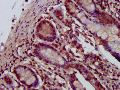 IHC image of CSB-PA619905LA01HU diluted at 1:400 and staining in paraffin-embedded human small intestine tissue performed on a Leica BondTM system. After dewaxing and hydration, antigen retrieval was mediated by high pressure in a citrate buffer (...