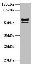Western blot All lanes: KRT72 antibody at 2µg/ml + MCF-7 whole cell lysate Secondary Goat polyclonal to rabbit IgG at 1/10000 dilution Predicted band size: 56, 52 kDa Observed band size: 56, 52 kDa