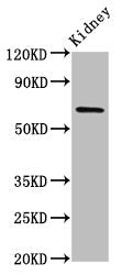 Western Blot Positive WB detected in: Rat kidney tissue All lanes: TNIP1 antibody at 7ug/ml Secondary Goat polyclonal to rabbit IgG at 1/50000 dilution Predicted band size: 72, 67, 65, 63, 62 kDa Observed band size: 72 kDa