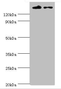 Western blot All lanes: SETDB1 antibody at 5ug/ml Lane 1: Rat adrenal gland tissue Lane 2: 293T whole cell lysate Secondary Goat polyclonal to rabbit IgG at 1/10000 dilution Predicted band size: 144, 45 kDa Observed band size: 144 kDa