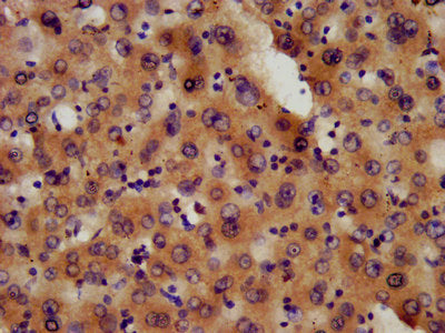 IHC image of CSB-PA619963LA01HU diluted at 1:600 and staining in paraffin-embedded human liver tissue performed on a Leica BondTM system. After dewaxing and hydration, antigen retrieval was mediated by high pressure in a citrate buffer (pH 6.0). S...