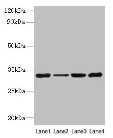 Western blot All lanes: PDCD1 antibody at 6µg/ml Lane 1: 293T whole cell lysate Lane 2: Hela whole cell lysate Lane 3: K562 whole cell lysate Lane 4: Mouse stomach tissue Secondary Goat polyclonal to rabbit IgG at 1/10000 dilution Predicted band s...