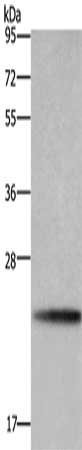 Gel: 10%SDS-PAGE, Lysate: 40 ug, Lane: A549 cells, Primary antibody: CSB-PA620085(BBC3 Antibody) at dilution 1/600, Secondary antibody: Goat anti rabbit IgG at 1/8000 dilution, Exposure time: 5 minutes