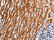 The image on the left is immunohistochemistry of paraffin-embedded Human liver cancer tissue using CSB-PA620355(ID4 Antibody) at dilution 1/20, on the right is treated with synthetic peptide. (Original magnification: ×200)