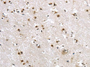 The image on the left is immunohistochemistry of paraffin-embedded Human brain tissue using CSB-PA620425(MRE11A Antibody) at dilution 1/20, on the right is treated with synthetic peptide. (Original magnification: ×200)