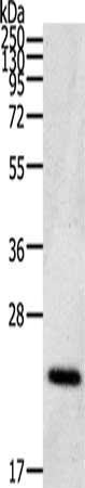 Gel: 12%SDS-PAGE, Lysate: 40 ug, Lane: Human fetal brain tissue, Primary antibody: CSB-PA620509(CDC42/RHO/RAC Antibody) at dilution 1/200, Secondary antibody: Goat anti rabbit IgG at 1/8000 dilution, Exposure time: 10 minutes