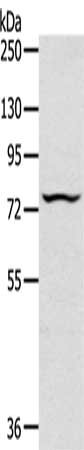 Gel: 6%SDS-PAGE, Lysate: 40 ug, Lane: Jurkat cells, Primary antibody: CSB-PA620512(TAP2 Antibody) at dilution 1/200, Secondary antibody: Goat anti rabbit IgG at 1/8000 dilution, Exposure time: 30 seconds