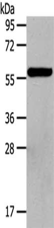 Gel: 6%SDS-PAGE,Lysate: 40 ug,,Primary antibody: CSB-PA620515(HDAC7 Antibody) at dilution 1/100 dilution,Secondary antibody: Goat anti rabbit IgG at 1/8000 dilution,Exposure time: 40 seconds