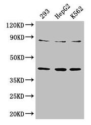 Western Blot Positive WB detected in: 293 whole cell lysate, HepG2 whole cell lysate, K562 whole cell lysate All lanes: PTPA antibody at 3.3µg/ml Secondary Goat polyclonal to rabbit IgG at 1/50000 dilution Predicted band size: 41, 37, 34, 32 kDa O...
