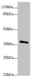 Western blot All lanes: POU4F3antibody at 1.97ug/ml + Mouse brain tissue Secondary Goat polyclonal to rabbit IgG at 1/10000 dilution Predicted band size: 37 kDa Observed band size: 37 kDa