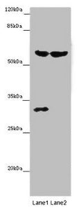 Western blot All lanes: TERF2 antibody at 14 ug/ml Lane 1: Mouse thymus tissue Lane 2: MCF-7 whole cell lysate Secondary Goat polyclonal to rabbit IgG at 1/10000 dilution Predicted band size: 60, 33 kDa Observed band size: 60, 31 kDa