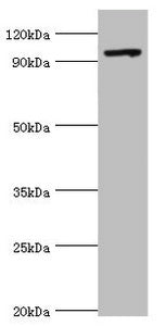 Western blot All lanes: TAF1C antibody at 2ug/ml + 293T whole cell lysate Secondary Goat polyclonal to rabbit IgG at 1/10000 dilution Predicted band size: 96, 85, 59, 50, 93 kDa Observed band size: 96 kDa