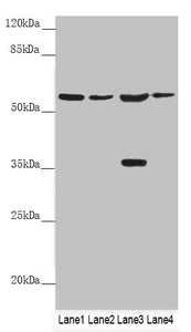 Western blot All lanes: SLC1A5 antibody at 9.89 ug/ml Lane 1: Mouse lung tissue Lane 2: Jurkat whole cell lysate Lane 3: 293T whole cell lysate Lane 4: Hela whole cell lysate Secondary Goat polyclonal to rabbit IgG at 1/10000 dilution Predicted ba...