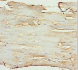 Immunohistochemistry of paraffin-embedded human skeletal muscle tissue using CSB-PA620892DSR2HU at dilution of 1:100