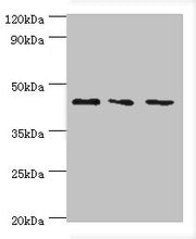Western blot All lanes: CHI3L2 antibody at 4ug/ml Lane 1: Hela whole cell lysate Lane 2: Rat brain tissue Lane 3: A431 whole cell lysate Secondary Goat polyclonal to rabbit IgG at 1/10000 dilution Predicted band size: 44, 35, 43 kDa Observed band...