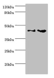 Western blot All lanes: CHI3L2 antibody at 4ug/ml Lane 1: Rat brain tissue Lane 2: A431 whole cell lysate Secondary Goat polyclonal to rabbit IgG at 1/10000 dilution Predicted band size: 44, 35, 43 kDa Observed band size: 44 kDa