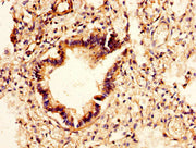 IHC image of CSB-PA620893LA01HU diluted at 1:400 and staining in paraffin-embedded human lung tissue performed on a Leica BondTM system. After dewaxing and hydration, antigen retrieval was mediated by high pressure in a citrate buffer (pH 6.0). Se...