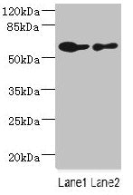Western blot All lanes: CHRNA6 antibody at 2.29µg/ml Lane 1: A431 whole cell lysate Lane 2: THP-1 whole cell lysate Secondary Goat polyclonal to rabbit IgG at 1/10000 dilution Predicted band size: 57, 56 kDa Observed band size: 57 kDa