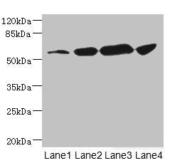 Western blot All lanes: CHRNA6 antibody at 3.72ug/ml Lane 1: A431 whole cell lysate Lane 2: A549 whole cell lysate Lane 3: Hela whole cell lysate Lane 4: HepG2 whole cell lysate Secondary Goat polyclonal to rabbit IgG at 1/10000 dilution Predicted...