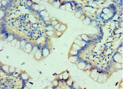 Immunohistochemistry of paraffin-embedded human small intestine tissue using CSB-PA620968ESR1HU at dilution of 1:100