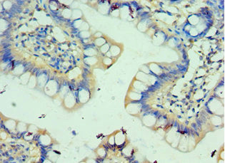 Immunohistochemistry of paraffin-embedded human small intestine tissue using CSB-PA620968ESR1HU at dilution of 1:100