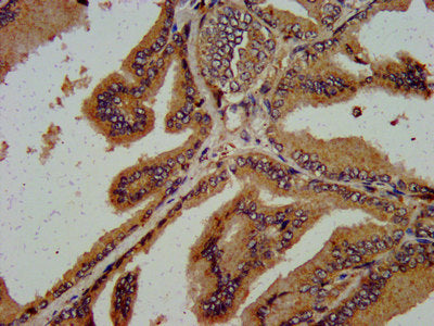 IHC image of CSB-PA620971LA01HU diluted at 1:600 and staining in paraffin-embedded human prostate tissue performed on a Leica BondTM system.