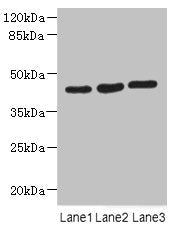 Western blot All lanes: MAPKAPK3 antibody at 4.4µg/ml Lane 1: Hela whole cell lysate Lane 2: Jurkat whole cell lysate Lane 3: MCF-7 whole cell lysate Secondary Goat polyclonal to rabbit IgG at 1/10000 dilution Predicted band size: 43 kDa Observed...