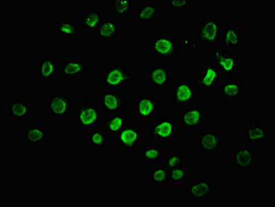 Immunofluorescence staining of A549 cells with CSB-PA620976LA01HU at 1:100, counter-stained with DAPI. The cells were fixed in 4% formaldehyde, permeabilized using 0.2% Triton X-100 and blocked in 10% normal Goat Serum. The cells were then incubat...
