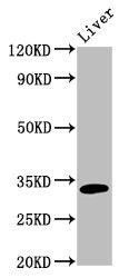 Western Blot Positive WB detected in: Rat liver tissue All lanes: TST antibody at 5ug/ml Secondary Goat polyclonal to rabbit IgG at 1/50000 dilution Predicted band size: 34 kDa Observed band size: 34 kDa