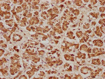 IHC image of CSB-PA620981LA01HU diluted at 1:100 and staining in paraffin-embedded human pancreatic tissue performed on a Leica BondTM system. After dewaxing and hydration, antigen retrieval was mediated by high pressure in a citrate buffer (pH 6....