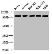 Western Blot Positive WB detected in: Hela whole cell lysate, Jurkat whole cell lysate, HEK293 whole cell lysate, NIH/3T3 whole cell lysate, A549 whole cell lysate All lanes: DDR2 antibody at 3.5ug/ml Secondary Goat polyclonal to rabbit IgG at 1/5...