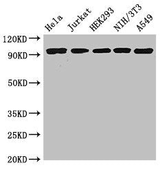 Western Blot Positive WB detected in: Hela whole cell lysate, Jurkat whole cell lysate, HEK293 whole cell lysate, NIH/3T3 whole cell lysate, A549 whole cell lysate All lanes: DDR2 antibody at 3.5ug/ml Secondary Goat polyclonal to rabbit IgG at 1/5...