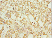 Immunohistochemistry of paraffin-embedded human adrenal gland tissue using CSB-PA621517DSR2HU at dilution of 1:100