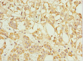 Immunohistochemistry of paraffin-embedded human adrenal gland tissue using CSB-PA621517DSR2HU at dilution of 1:100