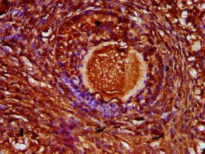 IHC image of CSB-PA621518LA01HU diluted at 1:300 and staining in paraffin-embedded human ovarian tissue performed on a Leica BondTM system. After dewaxing and hydration, antigen retrieval was mediated by high pressure in a citrate buffer (pH 6.0)....