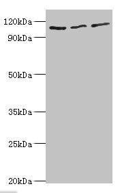 Western blot All lanes: MERTK antibody at 8ug/ml Lane 1: Mouse gonad tissue Lane 2: Mouse lung tissue Lane 3: Mouse kidney tissue Secondary Goat polyclonal to rabbit IgG at 1/10000 dilution Predicted band size: 110 kDa Observed band size: 110 kDa