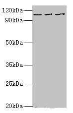 Western blot All lanes: MERTK antibody at 10ug/ml Lane 1: Mouse gonad tissue Lane 2: Mouse lung tissue Lane 3: Mouse kidney tissue Secondary Goat polyclonal to rabbit IgG at 1/10000 dilution Predicted band size: 110 kDa Observed band size: 110 kDa