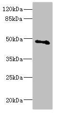 Western blot All lanes: COX10 antibody at 5.31ug/ml + Mouse gonadal tissue Secondary Goat polyclonal to rabbit IgG at 1/10000 dilution Predicted band size: 49, 28 kDa Observed band size: 49 kDa