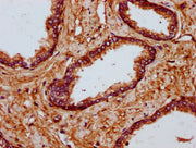 IHC image of CSB-PA621526LA01HU diluted at 1:700 and staining in paraffin-embedded human prostate tissue performed on a Leica BondTM system. After dewaxing and hydration, antigen retrieval was mediated by high pressure in a citrate buffer (pH 6.0)...