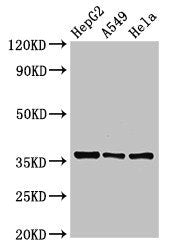 Western Blot Positive WB detected in: HepG2 whole cell lysate, A549 whole cell lysate, Hela whole cell lysate All lanes: ECH1 antibody at 2.5ug/ml Secondary Goat polyclonal to rabbit IgG at 1/50000 dilution Predicted band size: 36 kDa Observed ban...