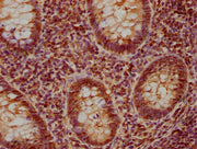 IHC image of CSB-PA621644NA01HU diluted at 1:840 and staining in paraffin-embedded human appendix tissue performed on a Leica BondTM system. After dewaxing and hydration, antigen retrieval was mediated by high pressure in a citrate buffer (pH 6.0)...
