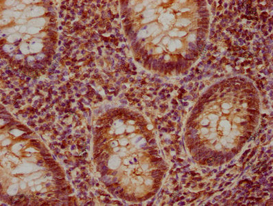 IHC image of CSB-PA621644NA01HU diluted at 1:840 and staining in paraffin-embedded human appendix tissue performed on a Leica BondTM system. After dewaxing and hydration, antigen retrieval was mediated by high pressure in a citrate buffer (pH 6.0)...