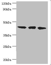 Western blot All lanes: TAR DNA-binding protein 43 antibody at 8ug/ml Lane 1: Hela whole cell lysate Lane 2: Mouse spleen tissue Lane: K562 whole cell lysate Secondary Goat polyclonal to rabbit IgG at 1/10000 dilution Predicted band size: 45, 32 k...