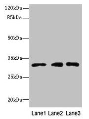 Western blot All lanes: PRDX4 antibody at 8µg/ml Lane 1: HepG2 whole cell lysate Lane 2: Hela whole cell lysate Lane 3: 293T whole cell lysate Secondary Goat polyclonal to rabbit IgG at 1/10000 dilution Predicted band size: 31 kDa Observed band si...
