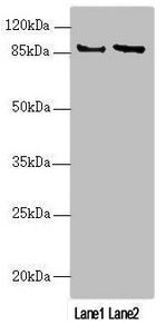 Western blot All lanes: MAPK8IP2 antibody at 2.85µg/ml Lane 1: U251 whole cell lysate Lane 2: A549 whole cell lysate Secondary Goat polyclonal to rabbit IgG at 1/10000 dilution Predicted band size: 88, 85, 65, 50 kDa Observed band size: 88 kDa