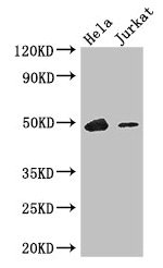 Western Blot Positive WB detected in: Hela whole cell lysate, Jurkat whole cell lysate All lanes: IKZF1 antibody at 3.4ug/ml Secondary Goat polyclonal to rabbit IgG at 1/50000 dilution Predicted band size: 58, 49, 48, 44, 42, 32, 53, 25 kDa Observ...