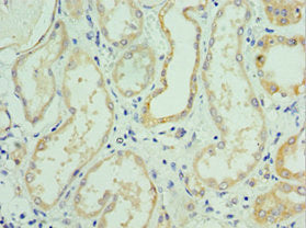 Immunohistochemistry of paraffin-embedded human kidney tissue using CSB-PA621669DSR1HU at dilution of 1:100