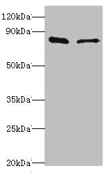 Western blot All lanes: SLC39A6 antibody at 10ug/ml Lane 1: Hela whole cell lysate Lane 2: 293T whole cell lysate Secondary Goat polyclonal to rabbit IgG at 1/10000 dilution Predicted band size: 86, 49 kDa Observed band size: 86 kDa