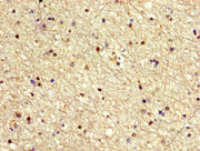 IHC image of CSB-PA621671LA01HU diluted at 1:500 and staining in paraffin-embedded human brain tissue performed on a Leica BondTM system. After dewaxing and hydration, antigen retrieval was mediated by high pressure in a citrate buffer (pH 6.0). S...